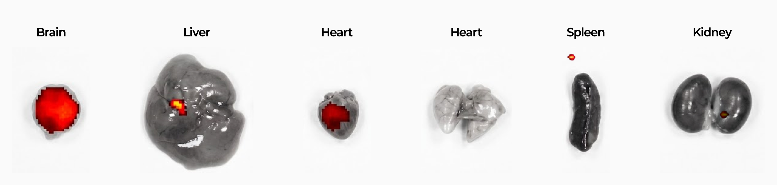 Organ delivery results - Brain, Liver, Heart, Heart, Spleen, Kidney